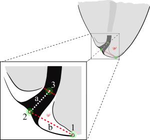 Diagram of Root Canal Treatment by Raleigh NC endodontist Dr. Horalek