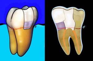 Illustration showing parts of your tooth, by Raleigh NC Endodontist Dr. Horalek
